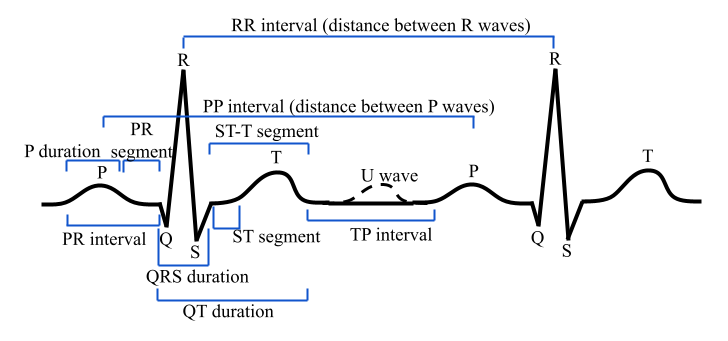 ecg.png